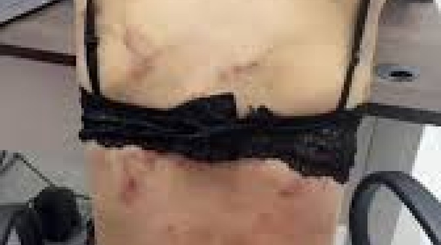 Homem procurado por agredir companheira com mordidas é preso