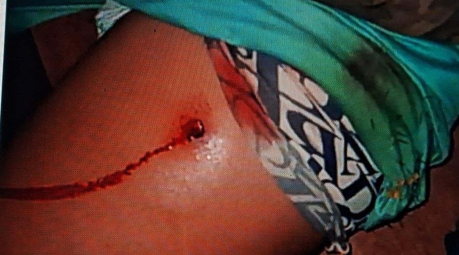 ustiça determina reforço da segurança em área de demarcação no Paraná