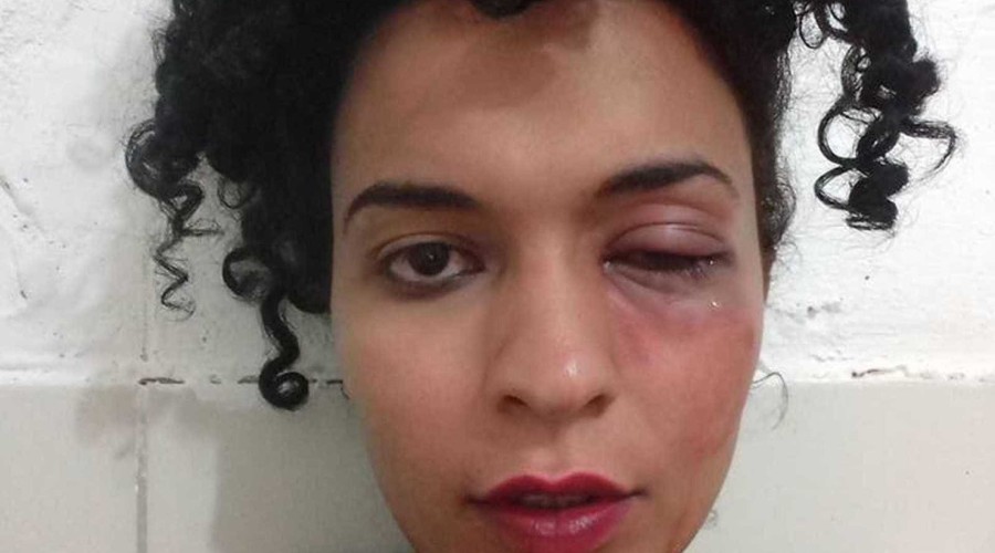 Estudante transexual é vítima de agressão dentro da UFPE