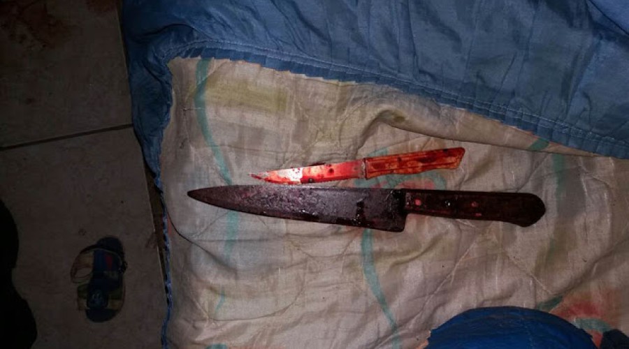 Esposa decepa pênis do marido após saber que ele tentou estuprar sua filha menor