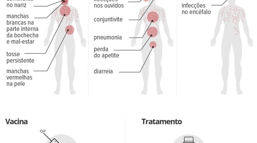 Campanha de vacinação contra o sarampo tem segunda fase em todo o país com foco em jovens adultos