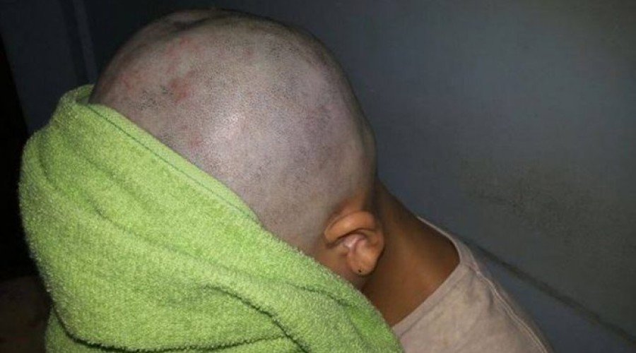 Jovem blindada tem cabeça raspada por trair traficante