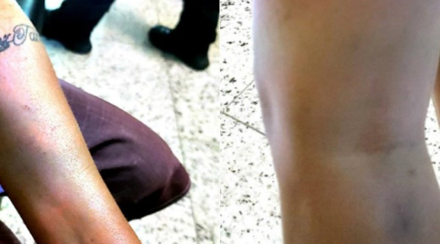 Mulher trans denuncia tortura e estupro com cabo de vassoura por policiais