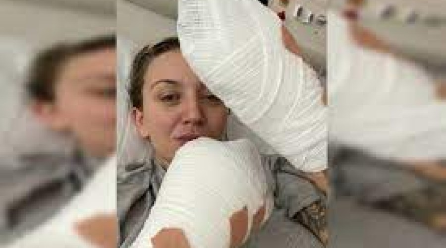 Mulher desmaia com dor nas costas e acorda sem os dedos. Entenda