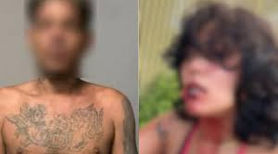 São Luís(MA): Homem arranca parte da boca da namorada ela foi atacada e espancada