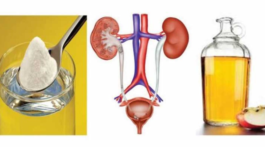 5 remédios caseiros para infecção urinária